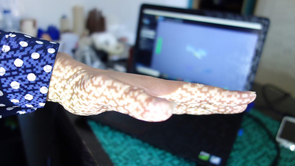 چاپ سه بعدی تولید پروتز دست